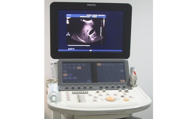 新一代心脏、血管高端彩超